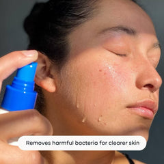 Hypochlorous Acid Skin Spray