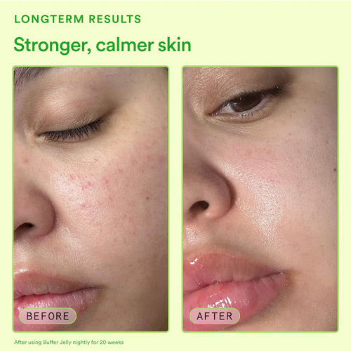 Buffer Jelly Facial Oil-Gel for Barrier Support with Ceramides