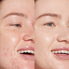 Swipe All-Over Hydrating Serum Concealer