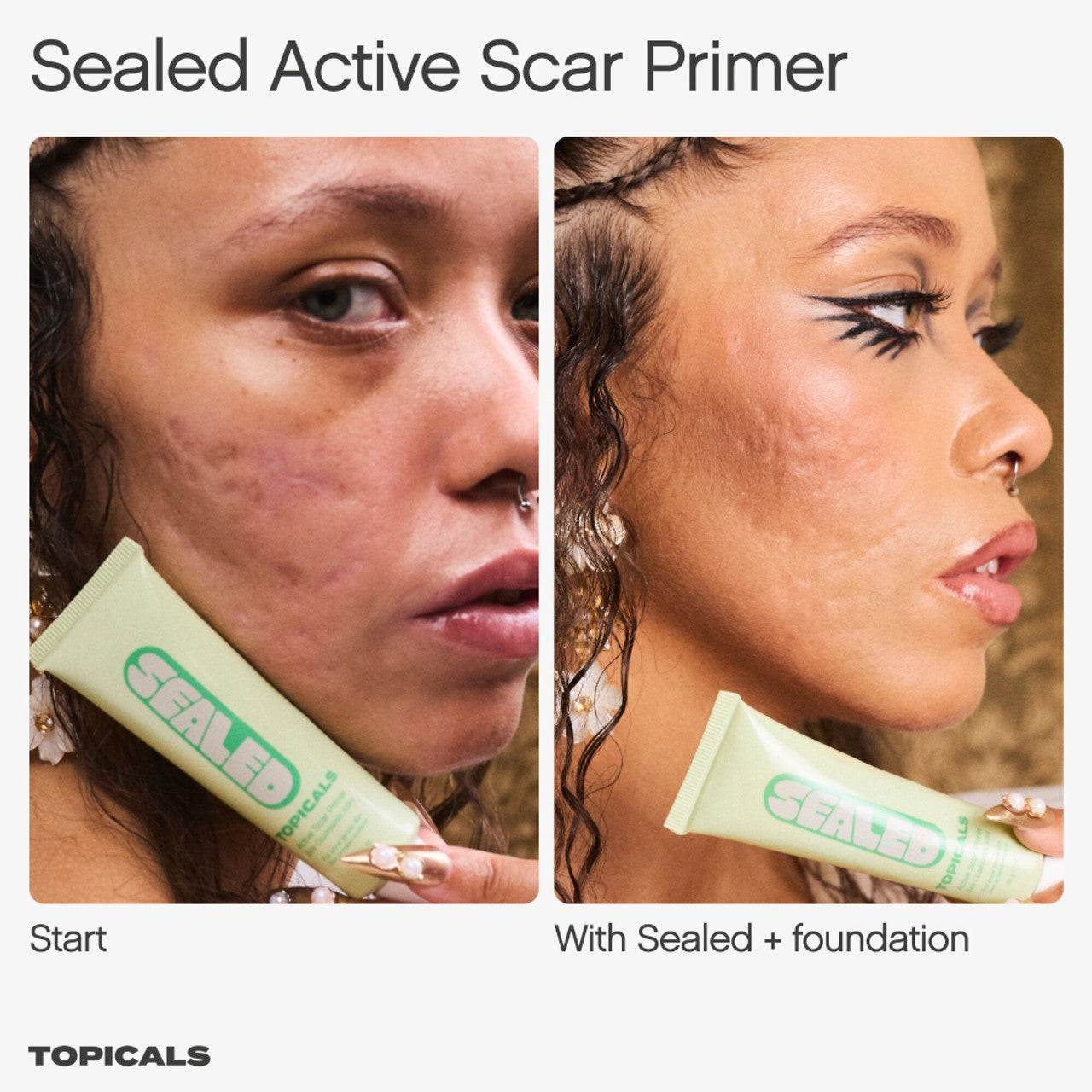 Sealed Active Scar Filling Primer for Acne Prone Skin