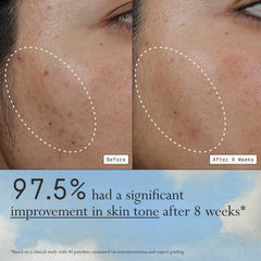 Deliverance 3-in-1 Repair Serum for Redness, Wrinkles, Dark Spots