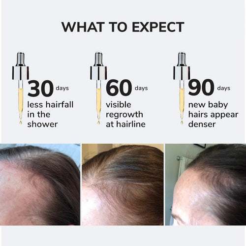 Youth Juice Collagen Scalp Serum for Thinning Hair