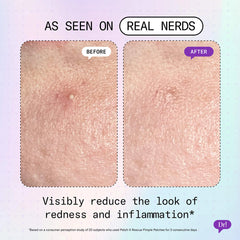 Patch It Azelaic Acid Rescue Pimple Patches