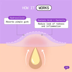 Patch It Azelaic Acid Rescue Pimple Patches