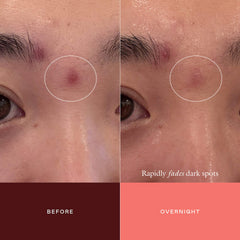 The Mark Advanced Targeted Dark Spot Concentrate