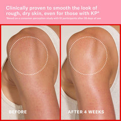 Pink Algae Pro-Retinol Body Butter for Anti-Aging and KP