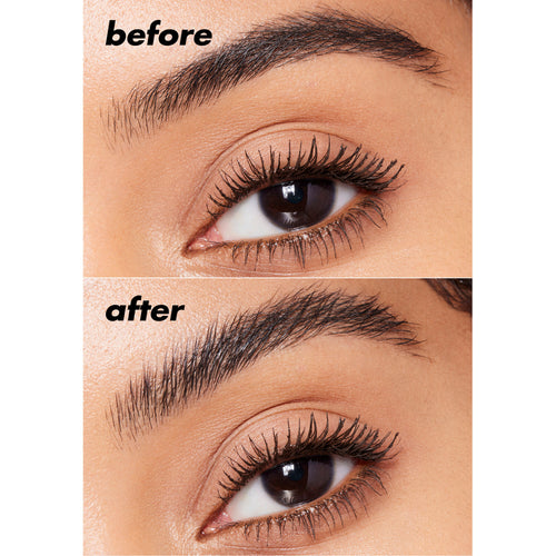 Brow Lift