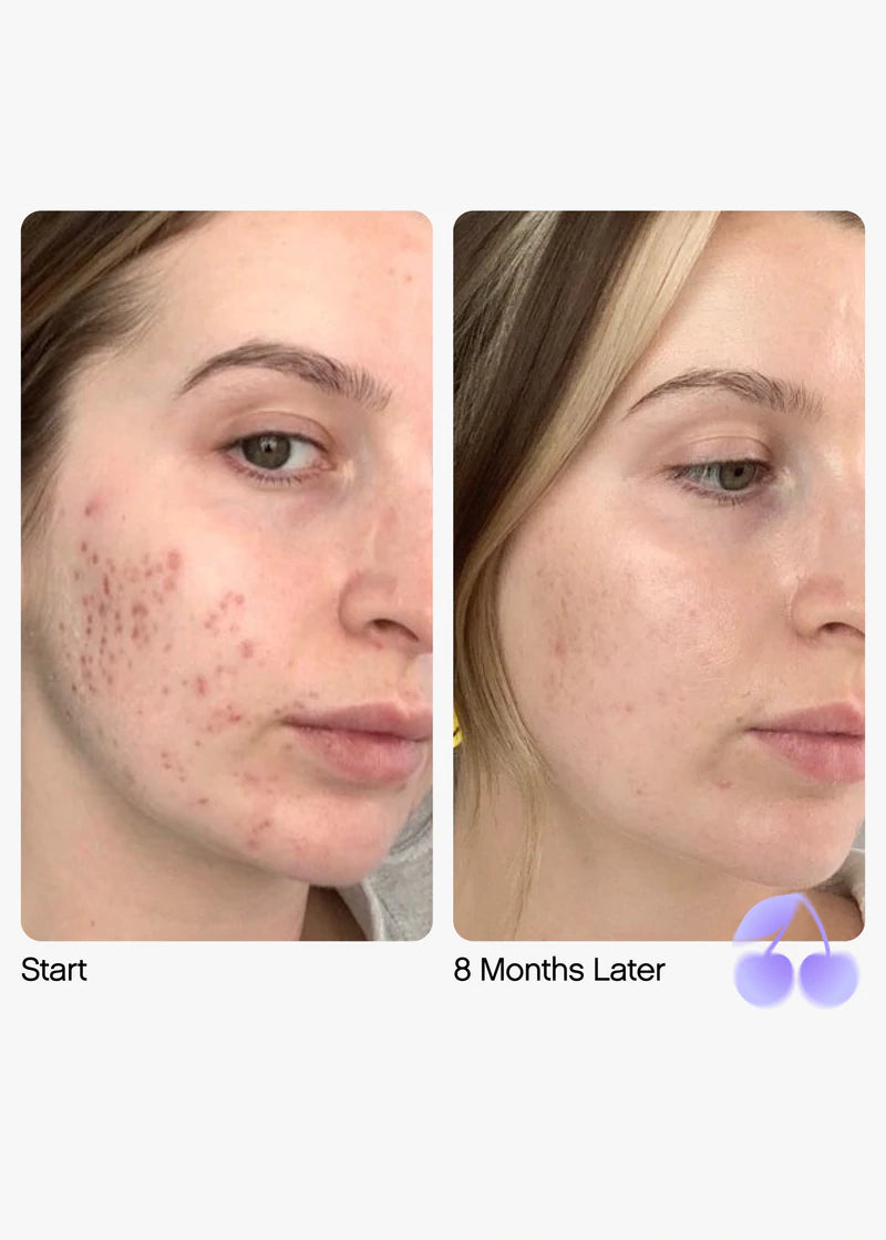 Faded Serum for Dark Spots & Discoloration