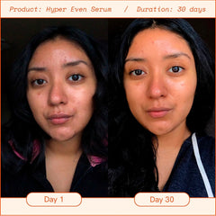 Brightening Dark Spot Vitamin C Serum