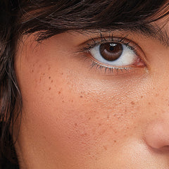 The Original Freckle