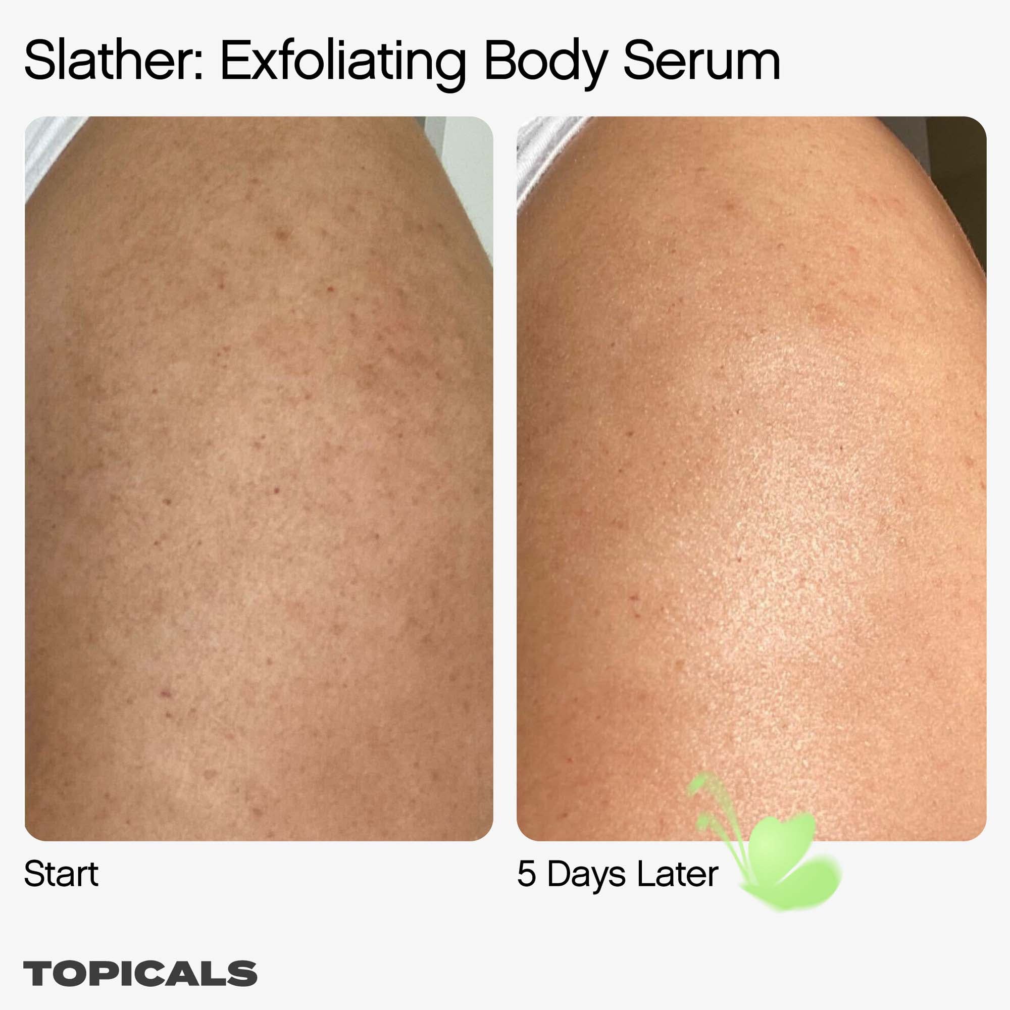 PREORDEN Topicals - Slather Exfoliating Body Serum with Retinol and AHAs