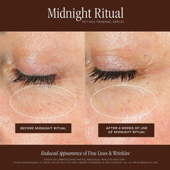 Midnight Ritual Retinol Renewal Serum